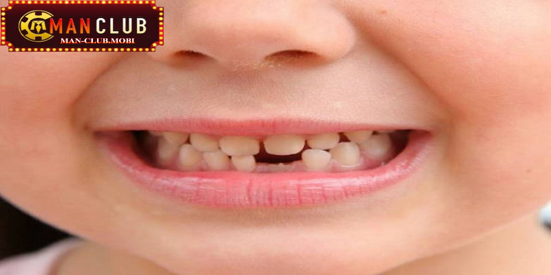 Mơ thấy rụng răng không chảy máu cần phải cẩn trọng đến sức khỏe